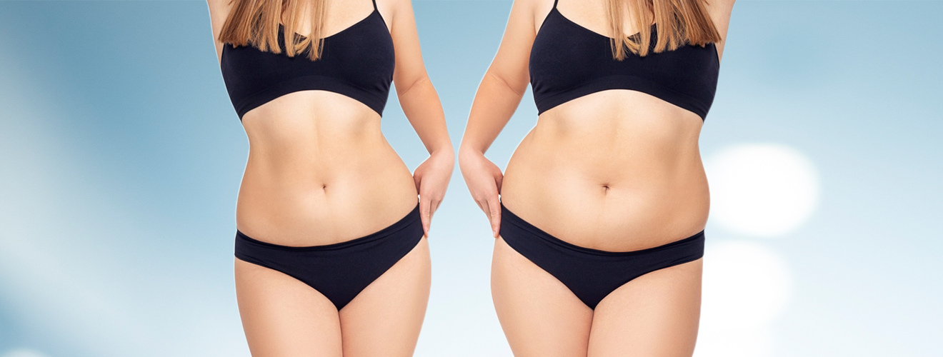 تجربتي مع عملية نحت الجسم