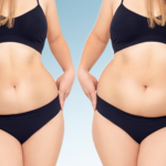 تجربتي مع عملية نحت الجسم