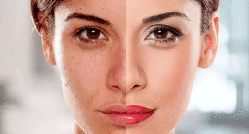 تفتيح البشرة