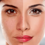 تفتيح البشرة