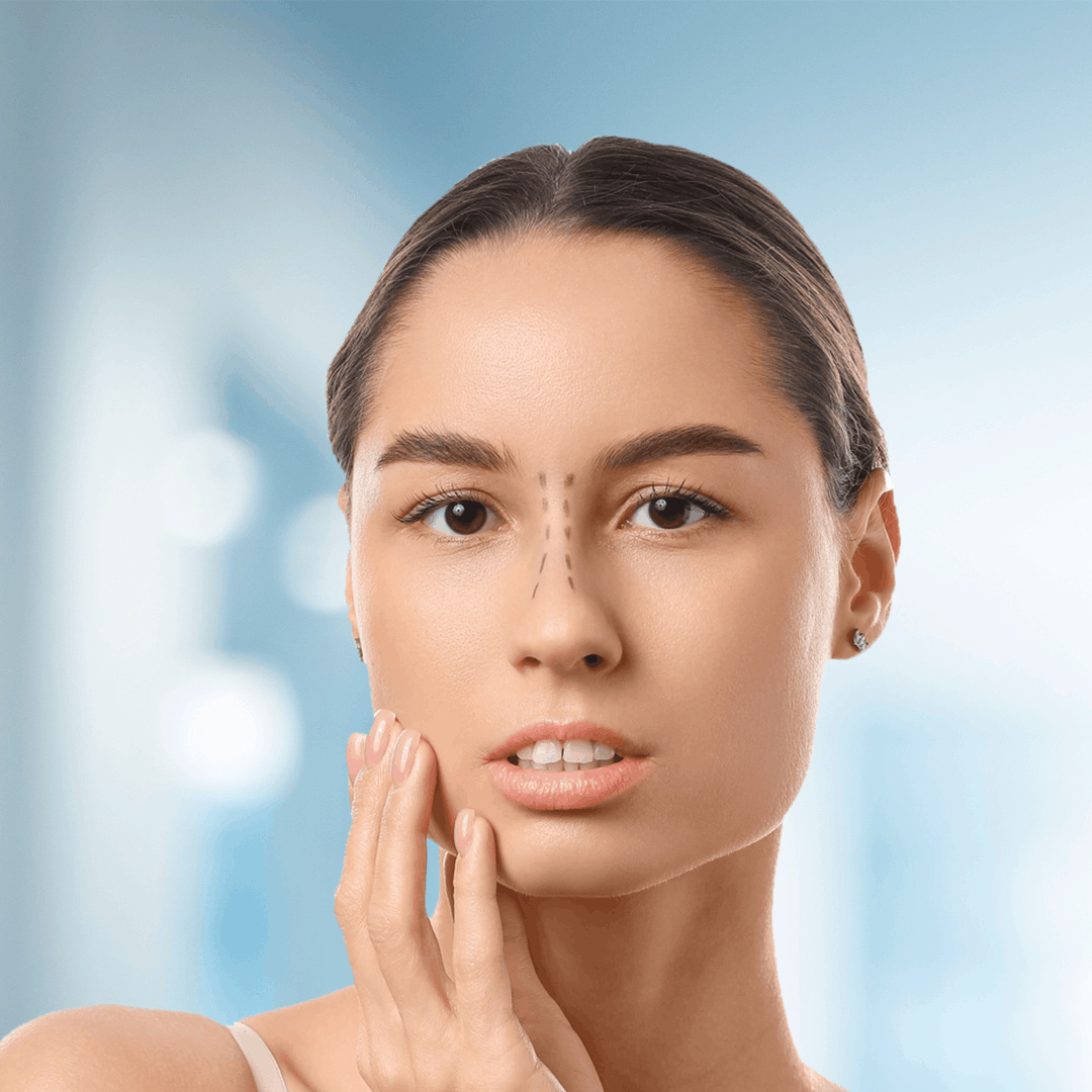 تجميل الأنف