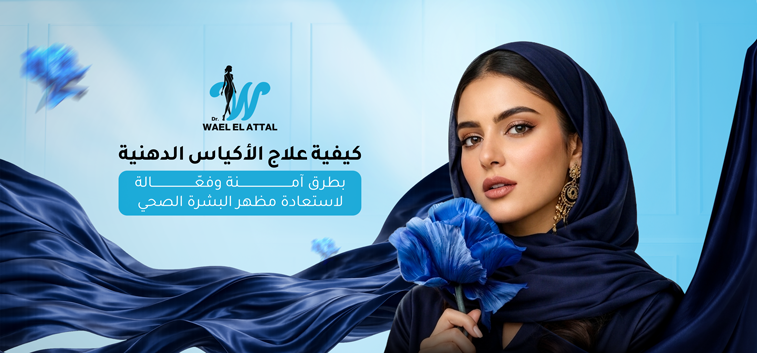 كيفية علاج الأكياس الدهنية