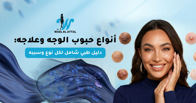 أنواع حبوب الوجه وعلاجها دليل طبي شامل لكل نوع وسببه أنواع حبوب الوجه