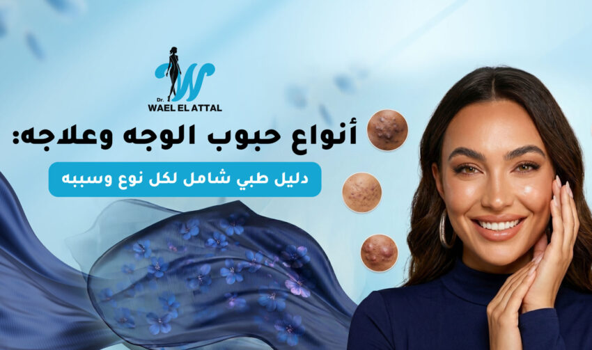 أنواع حبوب الوجه