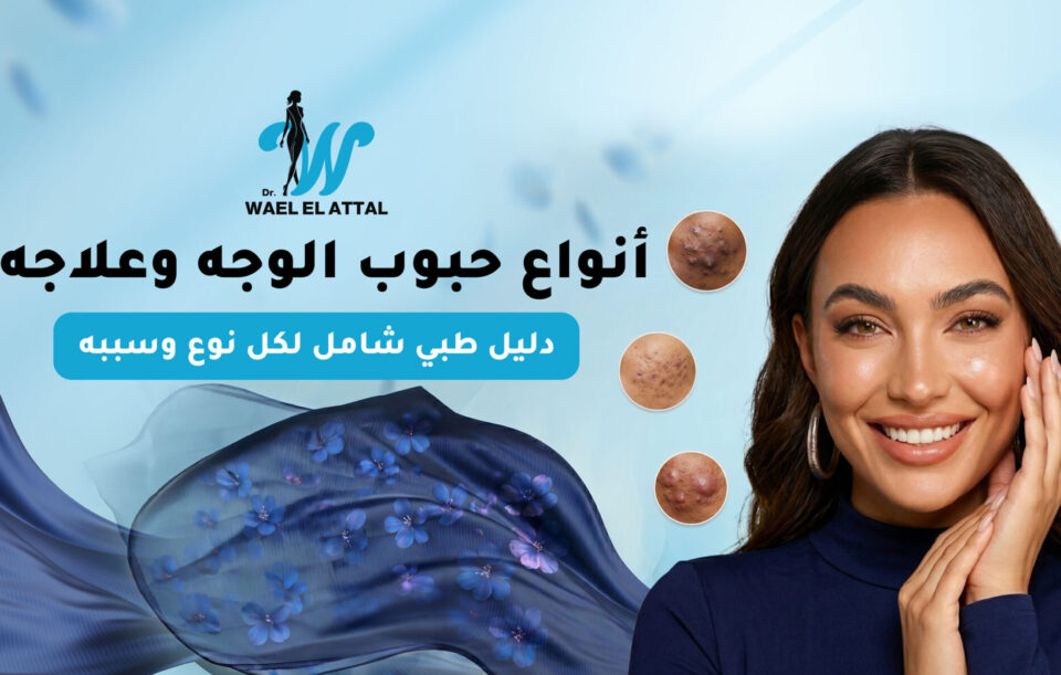 أنواع حبوب الوجه