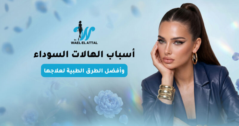أسباب الهالات السوداء