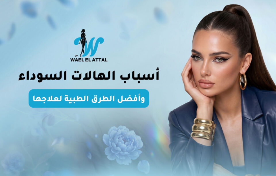 أسباب الهالات السوداء