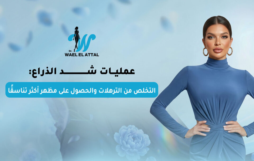 عمليات شد الذراع